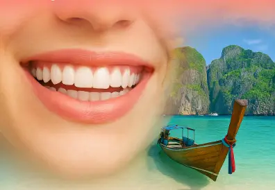 You are currently viewing Dental Tourism in Thailand: My Real Experience